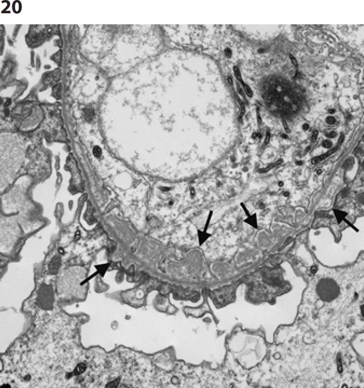 https://cdn.ncbi.nlm.nih.gov/pmc/blobs/e361/9677744/bac3d2efacef/gdz-0001-0135-g20.jpg