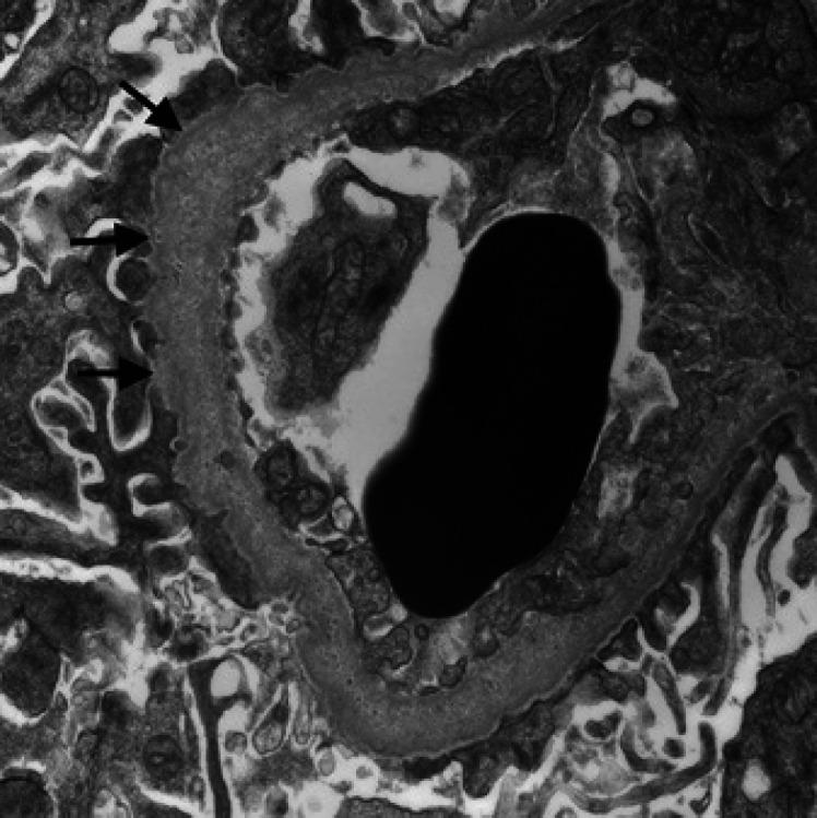 https://cdn.ncbi.nlm.nih.gov/pmc/blobs/e361/9677744/e962b61dced5/gdz-0001-0135-g13.jpg