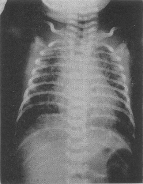 https://cdn.ncbi.nlm.nih.gov/pmc/blobs/e363/1921677/2fcc31dcd8ad/canmedaj01011-0005-a.jpg