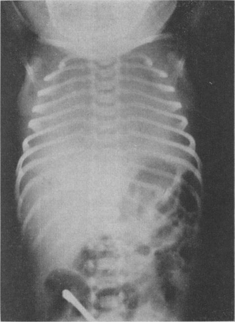 https://cdn.ncbi.nlm.nih.gov/pmc/blobs/e363/1921677/78aaf2231e78/canmedaj01011-0004-b.jpg