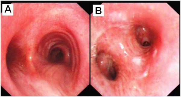 https://cdn.ncbi.nlm.nih.gov/pmc/blobs/e365/3856650/220bf7265e08/1746-1596-8-174-4.jpg