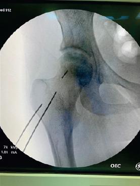 https://cdn.ncbi.nlm.nih.gov/pmc/blobs/e370/8046445/e631cf642cbe/JOCR-10-11-g002.jpg