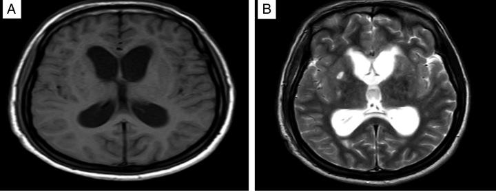 https://cdn.ncbi.nlm.nih.gov/pmc/blobs/e378/10783362/e13cfbddc3bf/ms9-86-594-g003.jpg