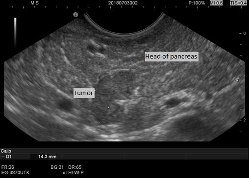 https://cdn.ncbi.nlm.nih.gov/pmc/blobs/e37b/7162563/b21ec9b00586/1556_Fig1.jpg