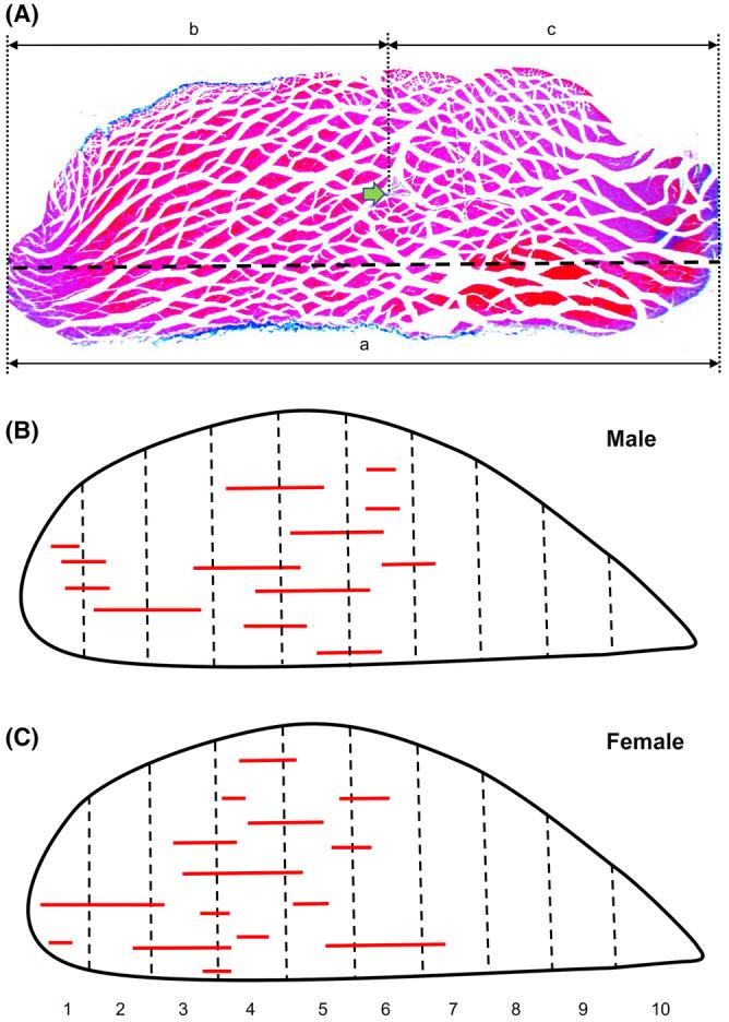 https://cdn.ncbi.nlm.nih.gov/pmc/blobs/e37d/10485582/9128244fbde1/JOA-243-658-g005.jpg