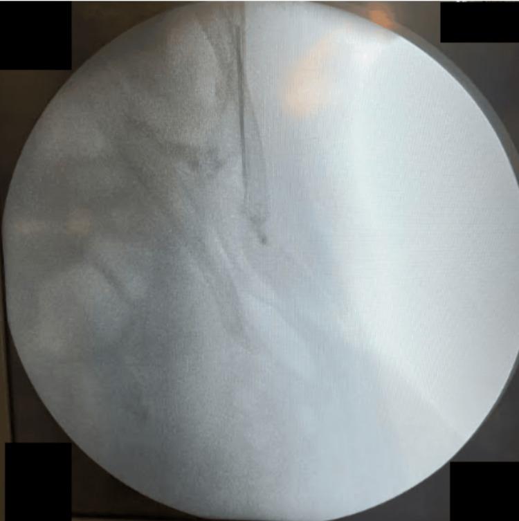 https://cdn.ncbi.nlm.nih.gov/pmc/blobs/e37d/12301637/0d1f0e8046af/cureus-0017-00000086892-i04.jpg