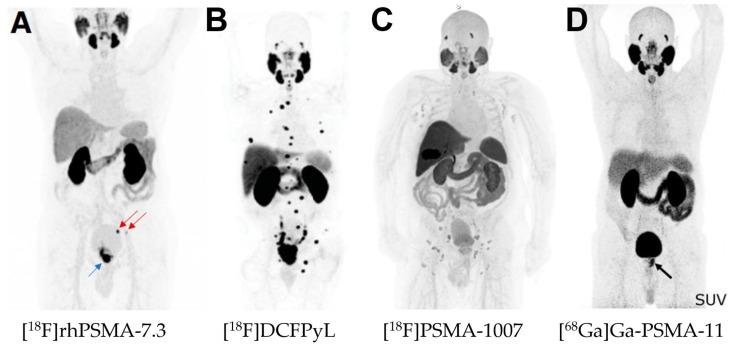 https://cdn.ncbi.nlm.nih.gov/pmc/blobs/e37e/12196200/fe252802c463/pharmaceuticals-18-00906-g003.jpg