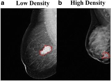 https://cdn.ncbi.nlm.nih.gov/pmc/blobs/e37f/6091349/8d69fd71180d/41235_2018_96_Fig1_HTML.jpg