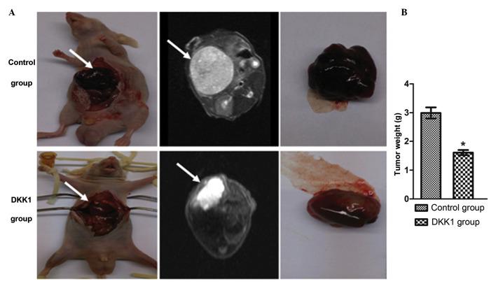 https://cdn.ncbi.nlm.nih.gov/pmc/blobs/e382/4686056/15a29199440b/MMR-13-01-0720-g02.jpg