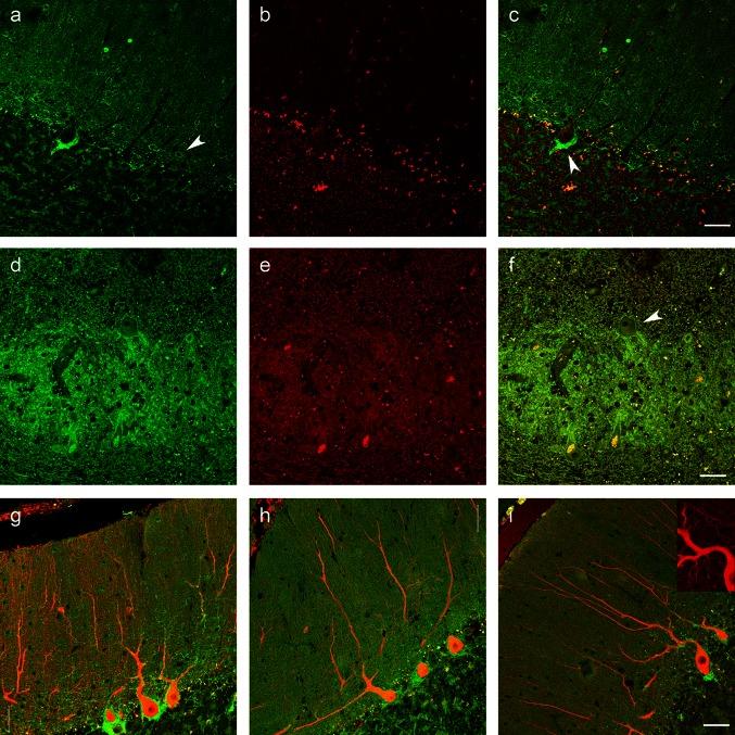 https://cdn.ncbi.nlm.nih.gov/pmc/blobs/e385/4059967/237df1442391/401_2014_1279_Fig8_HTML.jpg