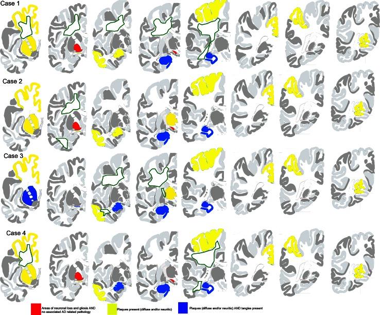 https://cdn.ncbi.nlm.nih.gov/pmc/blobs/e385/4059967/25c50813c8b3/401_2014_1279_Fig2_HTML.jpg