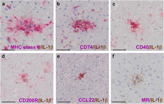 https://cdn.ncbi.nlm.nih.gov/pmc/blobs/e38b/4895983/08a5a664b74a/12974_2016_605_Fig5_HTML.jpg