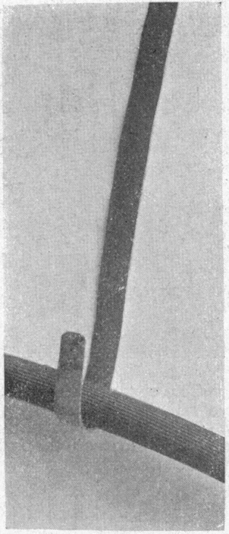 https://cdn.ncbi.nlm.nih.gov/pmc/blobs/e3a2/1406152/ac47eed5770e/annsurg00873-0027-c.jpg