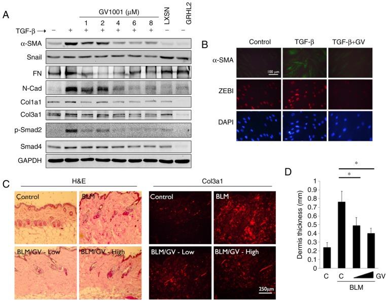 https://cdn.ncbi.nlm.nih.gov/pmc/blobs/e3a3/5881842/7d9202ac7aa3/IJMM-41-06-3211-g05.jpg