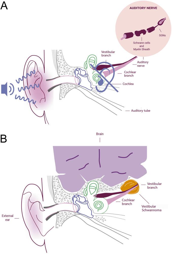 https://cdn.ncbi.nlm.nih.gov/pmc/blobs/e3ad/10517973/87c7521afe19/41419_2023_6141_Fig2_HTML.jpg