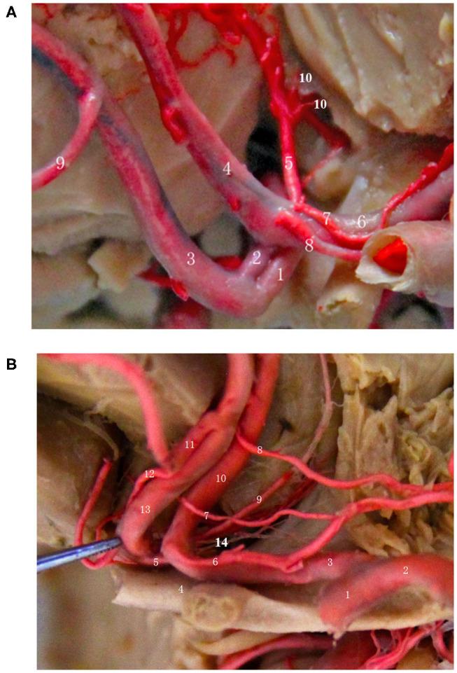 https://cdn.ncbi.nlm.nih.gov/pmc/blobs/e3be/7509403/86449e741aa4/fneur-11-01020-g0004.jpg