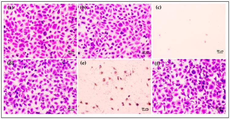 https://cdn.ncbi.nlm.nih.gov/pmc/blobs/e3c0/10780372/3d943ec3617e/polymers-16-00148-g007.jpg