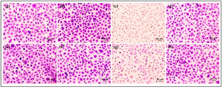 https://cdn.ncbi.nlm.nih.gov/pmc/blobs/e3c0/10780372/d149011289a8/polymers-16-00148-g008.jpg