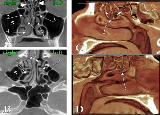 https://cdn.ncbi.nlm.nih.gov/pmc/blobs/e3c7/7716766/7d4203604e0f/CHSJ-46-03-297-fig1.jpg
