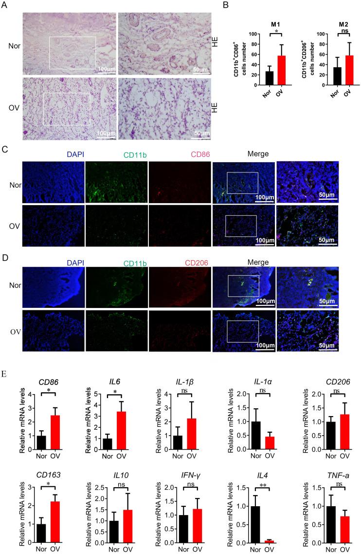 https://cdn.ncbi.nlm.nih.gov/pmc/blobs/e3cf/11521951/c496b9609717/fimmu-15-1458264-g011.jpg