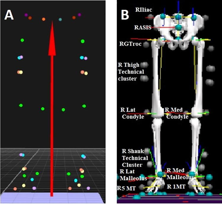 https://cdn.ncbi.nlm.nih.gov/pmc/blobs/e3dd/7653292/d06ee64ad655/10.1177_2325967120962802-fig1.jpg