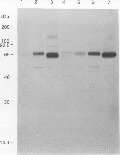 https://cdn.ncbi.nlm.nih.gov/pmc/blobs/e3de/1968213/935674564201/brjcancer00203-0062-c.jpg