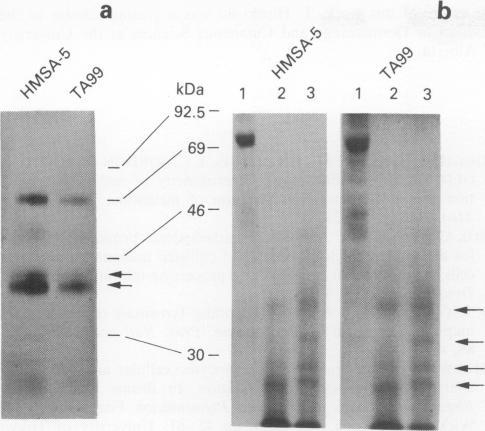 https://cdn.ncbi.nlm.nih.gov/pmc/blobs/e3de/1968213/d0c77f59b96b/brjcancer00203-0065-a.jpg