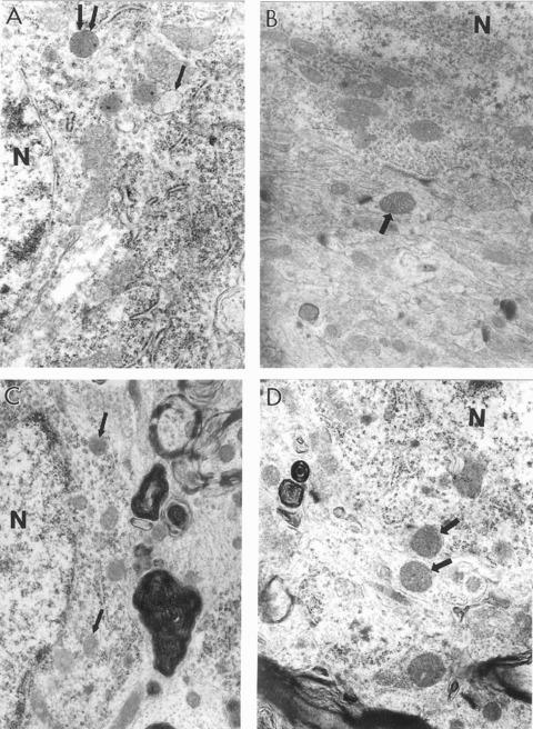 https://cdn.ncbi.nlm.nih.gov/pmc/blobs/e3e1/3823358/31a8f7b5a8ee/jcmm0013-0320-f1.jpg