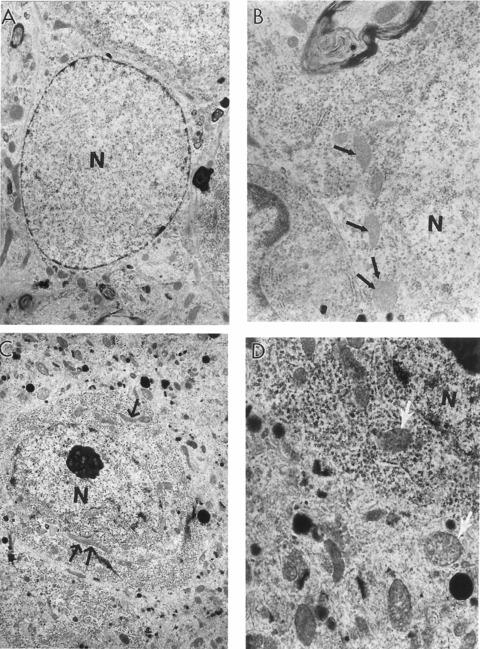 https://cdn.ncbi.nlm.nih.gov/pmc/blobs/e3e1/3823358/5c85ae96175b/jcmm0013-0320-f4.jpg