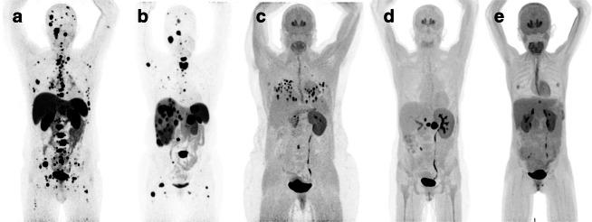 https://cdn.ncbi.nlm.nih.gov/pmc/blobs/e3e8/7456409/3f73d14a3385/11864_2020_787_Fig2_HTML.jpg