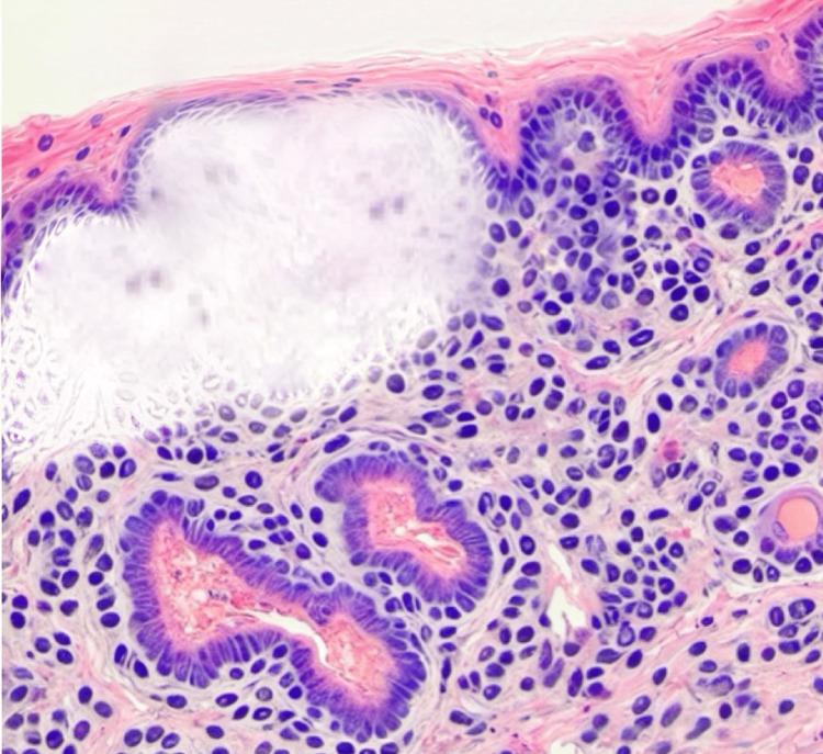 https://cdn.ncbi.nlm.nih.gov/pmc/blobs/e3ec/11578537/36867e95b79e/cureus-0016-00000074091-i02.jpg