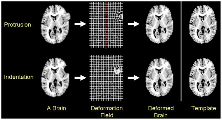 https://cdn.ncbi.nlm.nih.gov/pmc/blobs/e3f7/3517530/453fbd0279a7/pone.0050698.g002.jpg