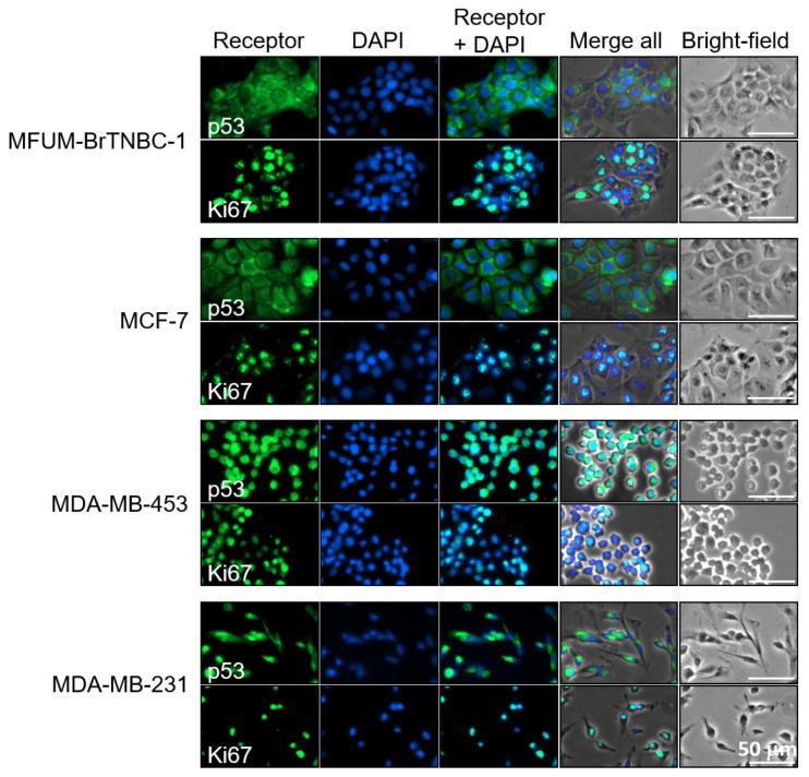 https://cdn.ncbi.nlm.nih.gov/pmc/blobs/e3f7/8749978/96e0d6fbd305/cells-11-00117-g005.jpg