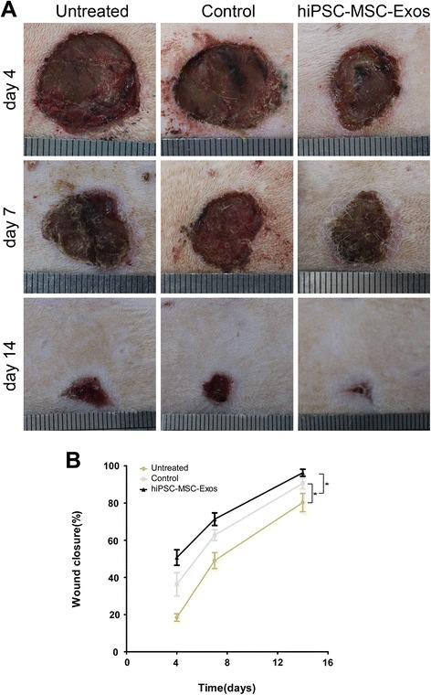 https://cdn.ncbi.nlm.nih.gov/pmc/blobs/e3fd/4371881/d5a6362fe12c/12967_2015_417_Fig2_HTML.jpg
