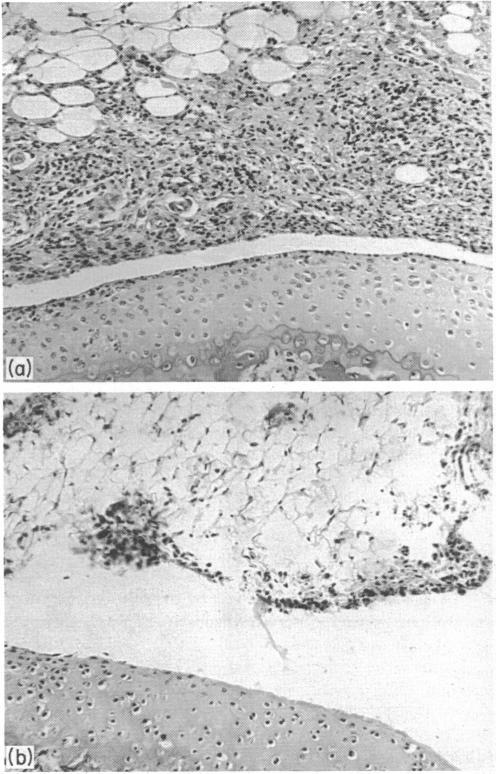 https://cdn.ncbi.nlm.nih.gov/pmc/blobs/e400/1454793/d695a4ef277c/immunology00161-0057-a.jpg