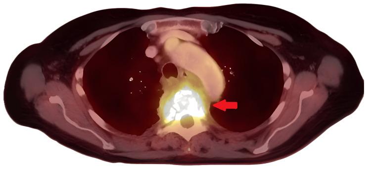 https://cdn.ncbi.nlm.nih.gov/pmc/blobs/e403/12056565/c6a6e3f767d6/cureus-0017-00000081816-i03.jpg