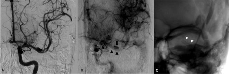 https://cdn.ncbi.nlm.nih.gov/pmc/blobs/e406/10139864/ad1a887a7c6e/gr5.jpg