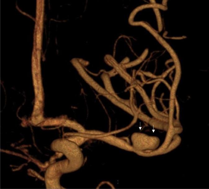 https://cdn.ncbi.nlm.nih.gov/pmc/blobs/e406/10139864/c84358b43168/gr4.jpg