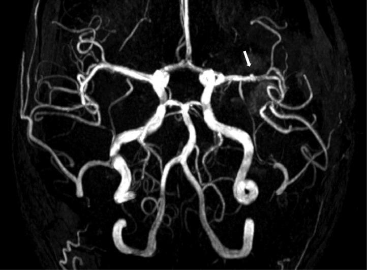 https://cdn.ncbi.nlm.nih.gov/pmc/blobs/e406/10139864/fac0b82f8bec/gr2.jpg