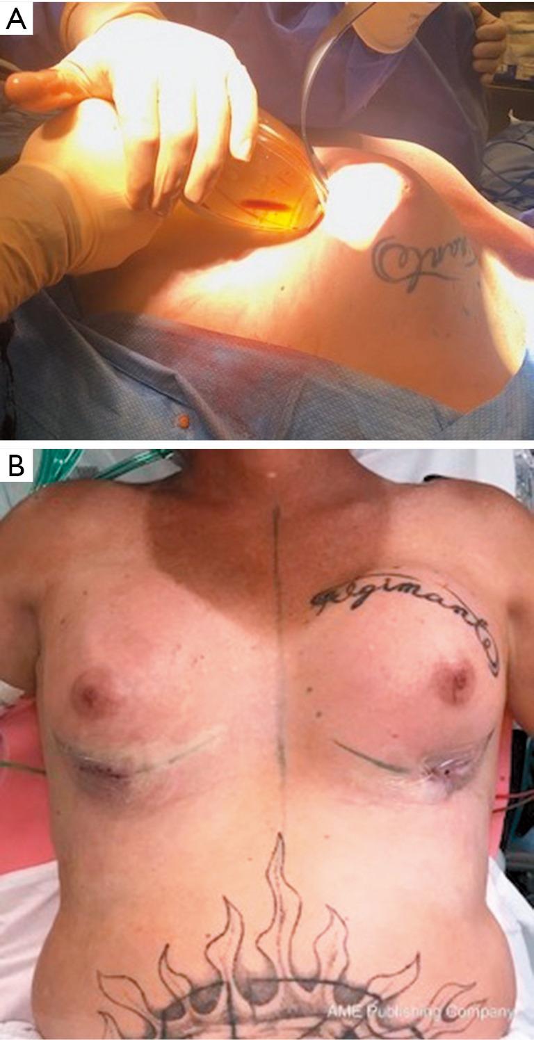 https://cdn.ncbi.nlm.nih.gov/pmc/blobs/e409/8105870/55f30b944629/atm-09-07-611-f2.jpg