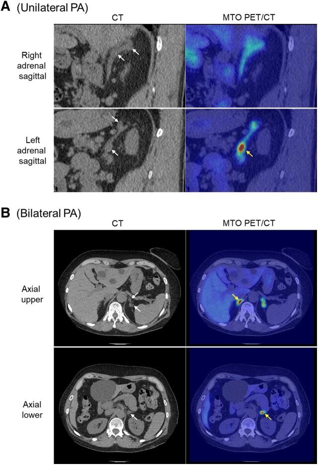 https://cdn.ncbi.nlm.nih.gov/pmc/blobs/e40b/10765166/0e80146beb95/bnad026f6.jpg