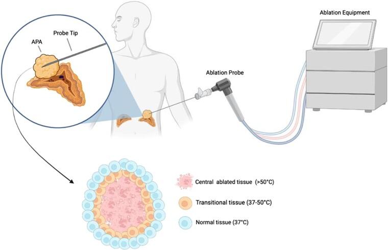 https://cdn.ncbi.nlm.nih.gov/pmc/blobs/e40b/10765166/738bcd94d711/bnad026f7.jpg