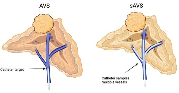 https://cdn.ncbi.nlm.nih.gov/pmc/blobs/e40b/10765166/a06d7b561e02/bnad026f5.jpg