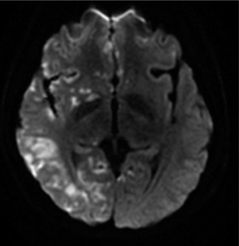 https://cdn.ncbi.nlm.nih.gov/pmc/blobs/e410/7337529/3e1de86e006b/medi-99-e20986-g004.jpg