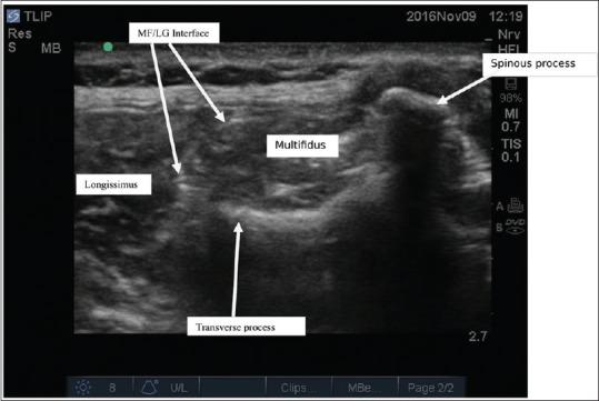 https://cdn.ncbi.nlm.nih.gov/pmc/blobs/e417/5389256/a772a7491fa4/SJA-11-248-g001.jpg