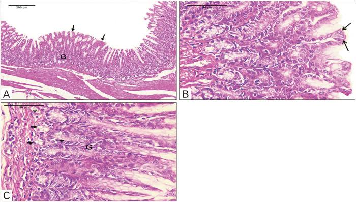 https://cdn.ncbi.nlm.nih.gov/pmc/blobs/e41a/10968197/bd14139574d2/acb-57-1-105-f4.jpg