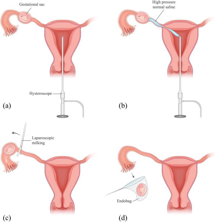 https://cdn.ncbi.nlm.nih.gov/pmc/blobs/e41b/12364717/0630105f8e27/CCR3-13-e70812-g001.jpg