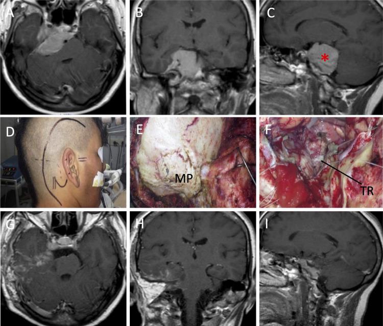 https://cdn.ncbi.nlm.nih.gov/pmc/blobs/e41b/8673693/cabf3d2b544d/cureus-0013-00000019609-i02.jpg