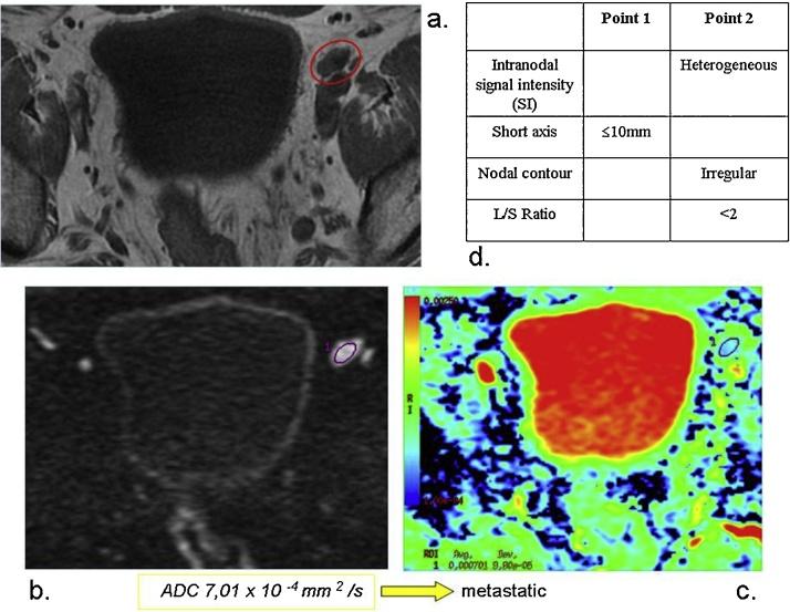 https://cdn.ncbi.nlm.nih.gov/pmc/blobs/e421/4811855/e349611cd21e/gr3.jpg