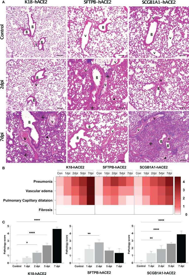 https://cdn.ncbi.nlm.nih.gov/pmc/blobs/e42c/9706212/ba86ad4642c1/fimmu-13-1055811-g002.jpg